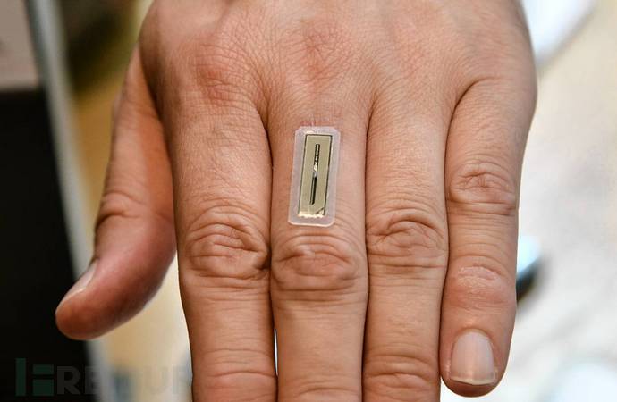 身体改造会是人类的未来吗?身体植入14枚插